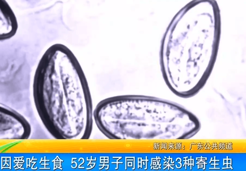 女子体内排出10米长绦虫<strong></p>
<p>理财易</strong>！原是两年前旅游时吃了这种食物