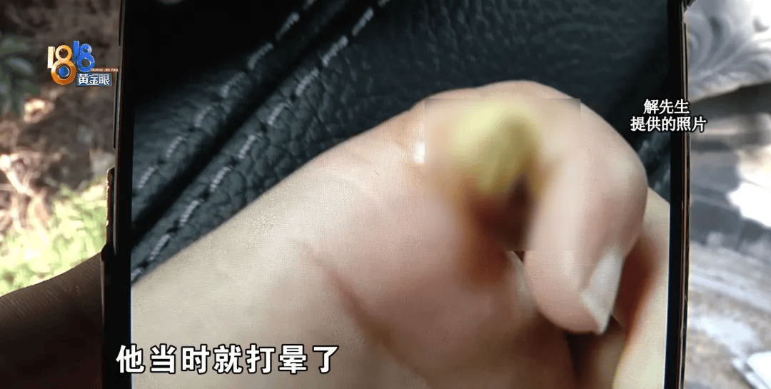 5岁男童瞬间晕厥<strong></p>
<p>理财官网</strong>，筋都断了！街上常见，看见立即远离