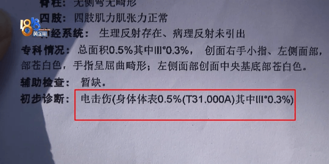 5岁男童瞬间晕厥<strong></p>
<p>理财官网</strong>，筋都断了！街上常见，看见立即远离