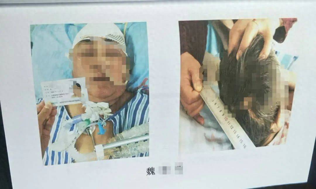 目睹母亲过马路被车撞<strong></p>
<p>学生理财</strong>，27岁女子受惊吓5天后身亡