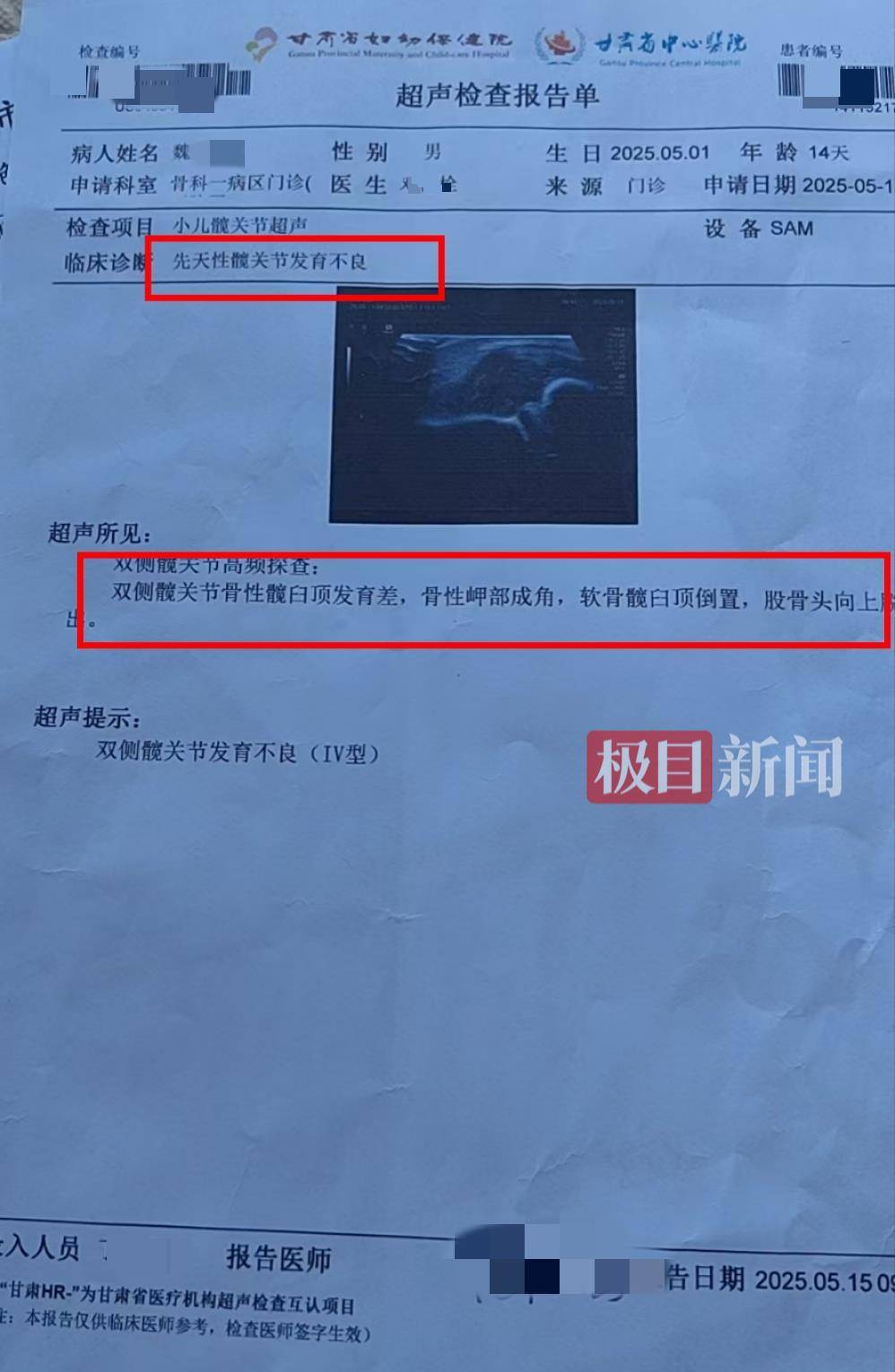 二胎出生查出先天性病症或落下残疾<strong></p>
<p>广发理财</strong>，残疾父母称医院产检漏检、未尽告知义务，医院及医调委回应
