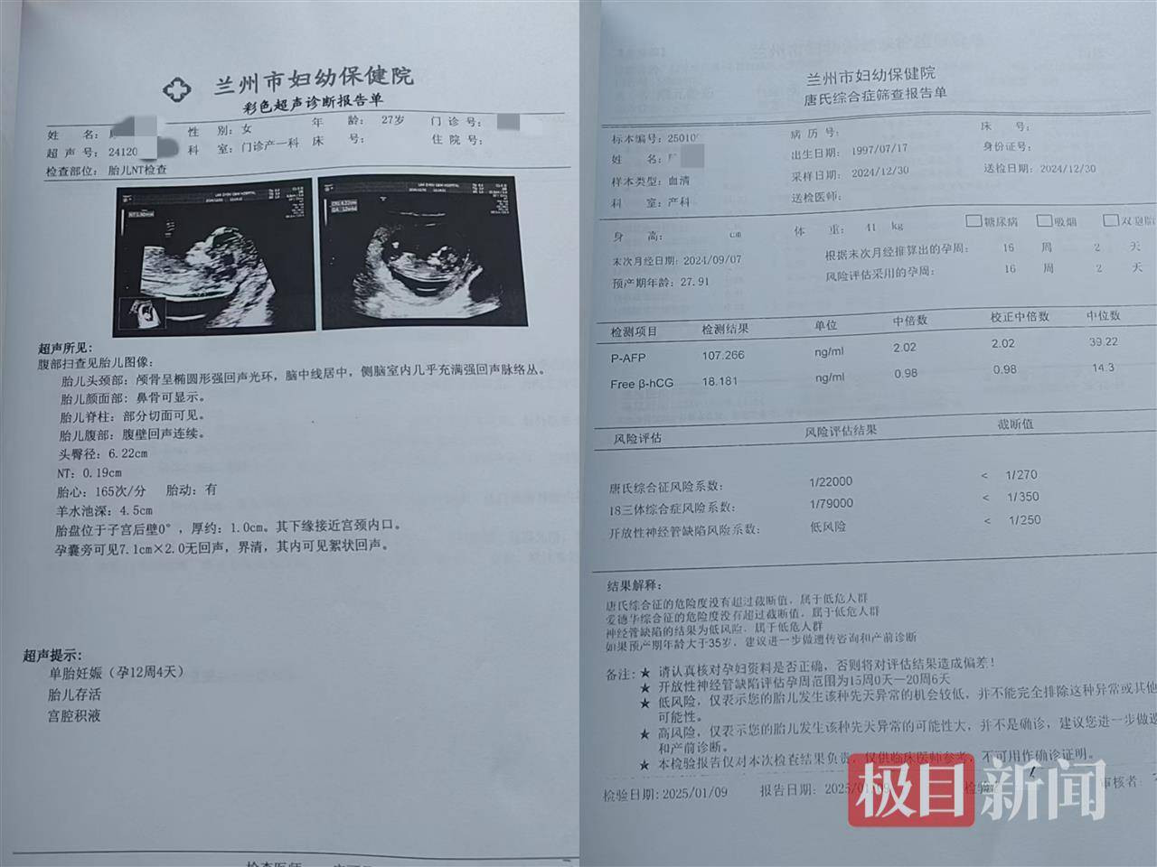 二胎出生查出先天性病症或落下残疾<strong></p>
<p>广发理财</strong>，残疾父母称医院产检漏检、未尽告知义务，医院及医调委回应
