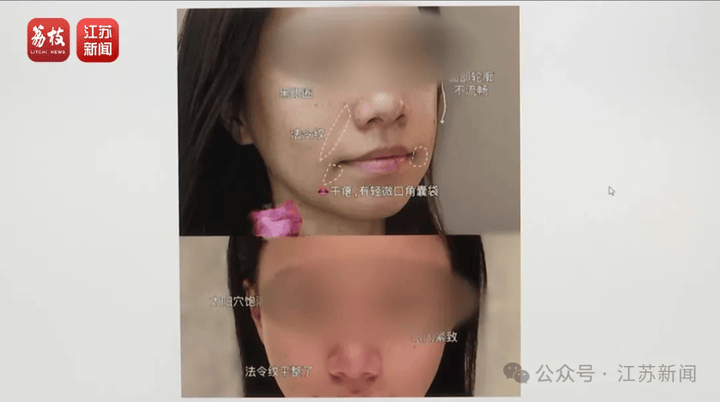 打一针“返老还童”的童颜针卖了30亿<strong></p>
<p>跑路理财</strong>，真的有效吗？