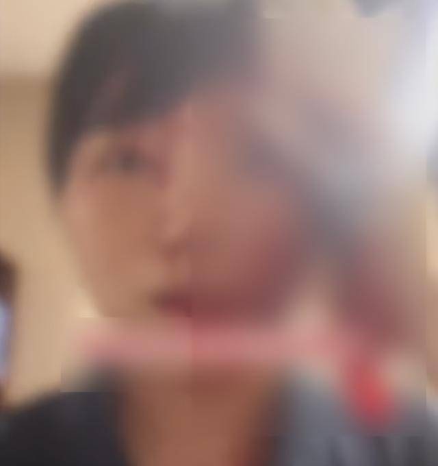缝了20多针！女子称被不知名男同事砸头毁容<strong></p>
<p>民生银行理财</strong>，警方介入