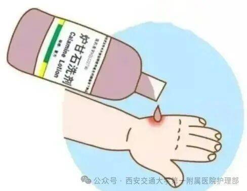 西安多区发现隐翅虫？千万别拍<strong></p>
<p>稳理财</strong>！毒液堪比硫酸