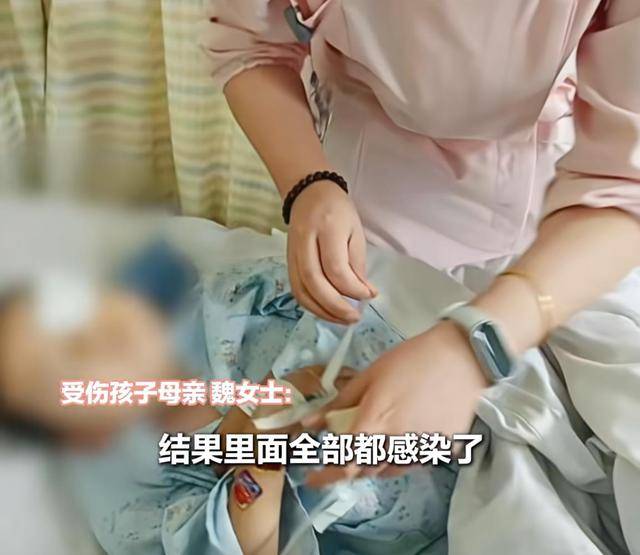 江西一5岁男孩在幼儿园被戳伤致左眼失明<strong></p>
<p>基础理财</strong>,家长称老师用猪油涂抹试图消肿