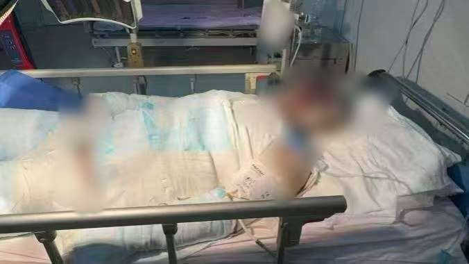 父子在哈尔滨一亲戚公司上班遇爆炸全身烧伤<strong></p>
<p>理财教程</strong>,治疗花费近百万公司拒赔偿?亲戚回应