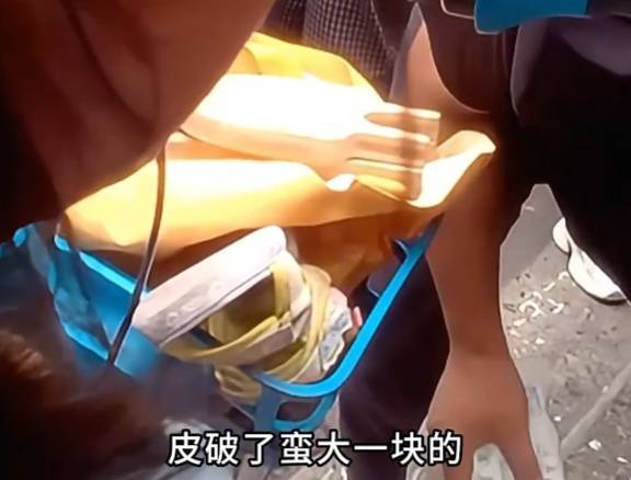 看着都疼<strong></p>
<p>理财钱包</strong>!上海街头一男子突然求助:10岁女儿被死死卡住!这个行为太危险→