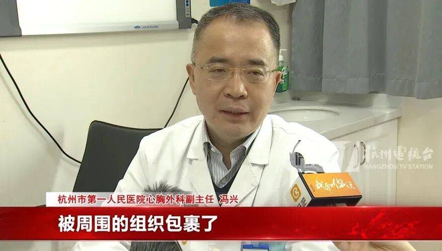 17岁小伙参军体检发现胸腔内有根5cm缝衣针<strong></p>
<p>理财书籍推荐</strong>,父母回忆或是1岁时扎入,取出时已锈迹斑斑