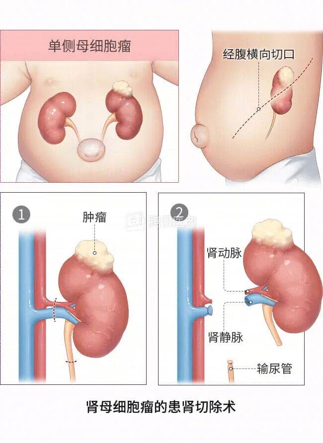 “感觉天塌了”！深圳女孩5岁患癌<strong></p>
<p>30万理财</strong>，爸妈决定：为她冻存卵巢组织