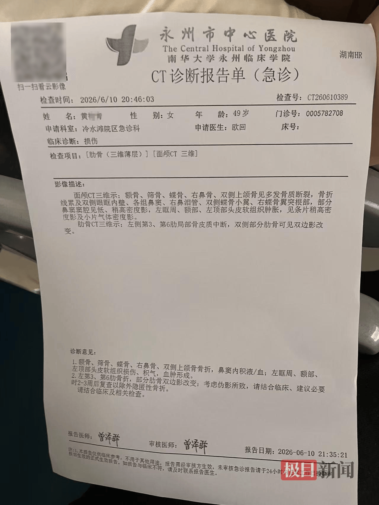 永州一小区发生电梯故障致多人被困<strong></p>
<p>理财观念</strong>，一名49岁女子跳出轿厢时坠亡，家属质疑物业保安打开轿厢违规操作